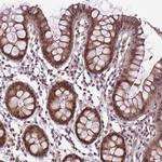 LIAR Antibody in Immunohistochemistry (Paraffin) (IHC (P))