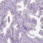 CTAG2 Antibody in Immunohistochemistry (Paraffin) (IHC (P))
