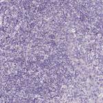 CTAG2 Antibody in Immunohistochemistry (Paraffin) (IHC (P))