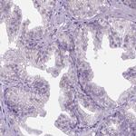 CTAG2 Antibody in Immunohistochemistry (IHC)