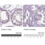 CTAG2 Antibody