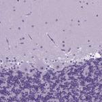FOXI1 Antibody in Immunohistochemistry (Paraffin) (IHC (P))