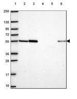 HS3ST3A1 Antibody in Western Blot (WB)