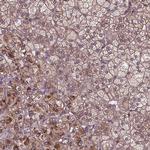 ZNF616 Antibody in Immunohistochemistry (Paraffin) (IHC (P))