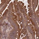 FAM116A Antibody in Immunohistochemistry (Paraffin) (IHC (P))