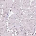 GAL3ST2 Antibody in Immunohistochemistry (Paraffin) (IHC (P))