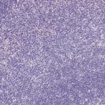 GAL3ST2 Polyclonal Antibody