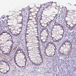 GAL3ST2 Antibody in Immunohistochemistry (IHC)