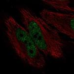 HES7 Polyclonal Antibody