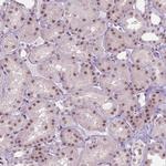 HES7 Antibody in Immunohistochemistry (Paraffin) (IHC (P))
