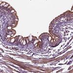 DNASE1L1 Polyclonal Antibody