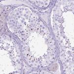 ARL9 Antibody in Immunohistochemistry (Paraffin) (IHC (P))