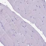 ARL9 Antibody in Immunohistochemistry (IHC)