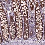 ARL1 Polyclonal Antibody