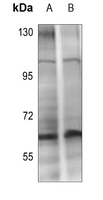 Phospho-CHK2 (Thr432) Antibody in Western Blot (WB)