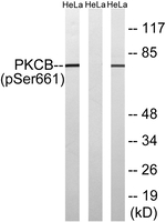 Phospho-PKC beta (Ser660) Antibody in Western Blot (WB)
