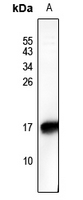 Phospho-HMGN2 (Ser29) Antibody in Western Blot (WB)