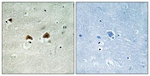 Phospho-MAP4 (Ser696) Antibody in Immunohistochemistry (Paraffin) (IHC (P))