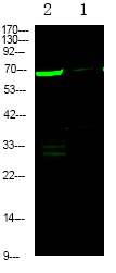 Phospho-L-Plastin (Ser5) Antibody in Western Blot (WB)