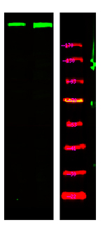 Phospho-ATM (Ser367) Antibody in Western Blot (WB)