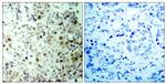 Phospho-CDK1 (Thr161) Polyclonal Antibody