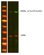 Phospho-PDGFRB (Tyr579, Tyr581) Polyclonal Antibody