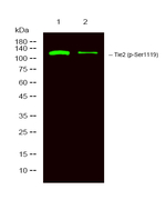 Phospho-TEK (Ser1119) Antibody in Western Blot (WB)