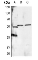 Phospho-RXRA (Ser260) Polyclonal Antibody