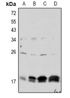Phospho-Claudin 4 (Tyr208) Antibody in Western Blot (WB)