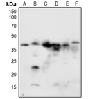 Phospho-NACA (Ser43) Antibody in Western Blot (WB)
