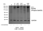 Phospho-RAD50 (Ser635) Antibody in Western Blot (WB)