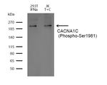 Phospho-CaV1.2 (Ser1981) Polyclonal Antibody