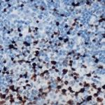 Phospho-ETS1 (Ser251) Polyclonal Antibody