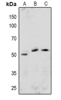 Phospho-ETS1 (Ser251) Antibody in Western Blot (WB)