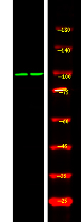 Phospho-Androgen Receptor (Ser308) Antibody in Western Blot (WB)