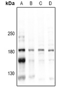 Phospho-CD45 (Tyr1216) Antibody in Western Blot (WB)