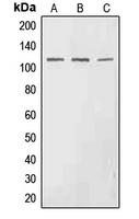 Phospho-EphA3 (Tyr602) Polyclonal Antibody