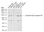 Phospho-EphB1 (Tyr928) Antibody in Western Blot (WB)
