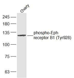 Phospho-EphB1 (Tyr928) Antibody in Western Blot (WB)