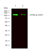 Phospho-EphB4 (Tyr987) Polyclonal Antibody