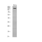 Phospho-PDE3A (Ser312) Polyclonal Antibody