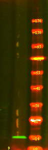 Phospho-S100A9 (Thr113) Antibody in Western Blot (WB)