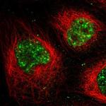 MPP1 Polyclonal Antibody