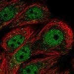 PPP1R3F Polyclonal Antibody