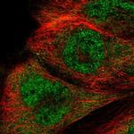 RTCB Polyclonal Antibody