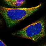 TOM1 Antibody in Immunocytochemistry (ICC/IF)