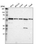 TOM1 Antibody in Western Blot (WB)