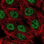 LHX2 Polyclonal Antibody