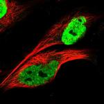 KHDRBS3 Polyclonal Antibody