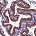 ZNF630 Polyclonal Antibody